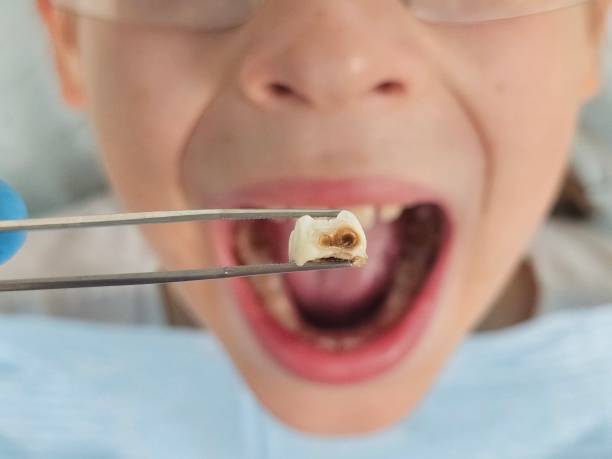 Best Pediatric Emergency Dentist in Monticello, WI